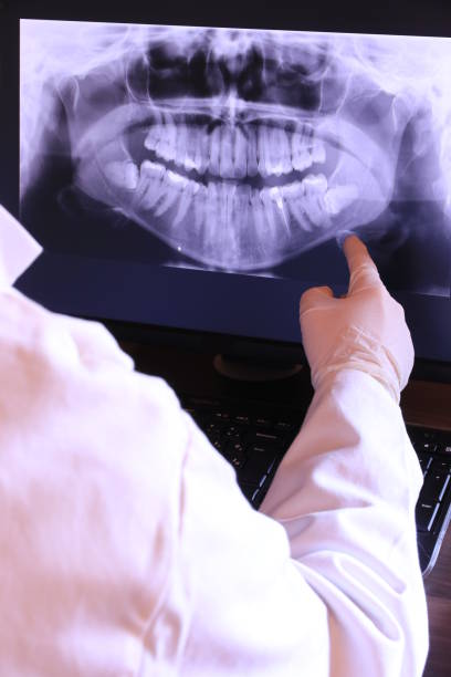 Best Emergency Root Canal Treatment in Middleburg, PA