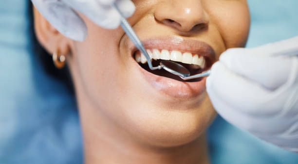 Best Broken or Cracked Tooth Emergency Dentist in Middleburg, PA