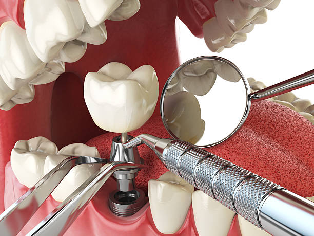 Best Holiday Emergency Dentist in Middleburg, PA
